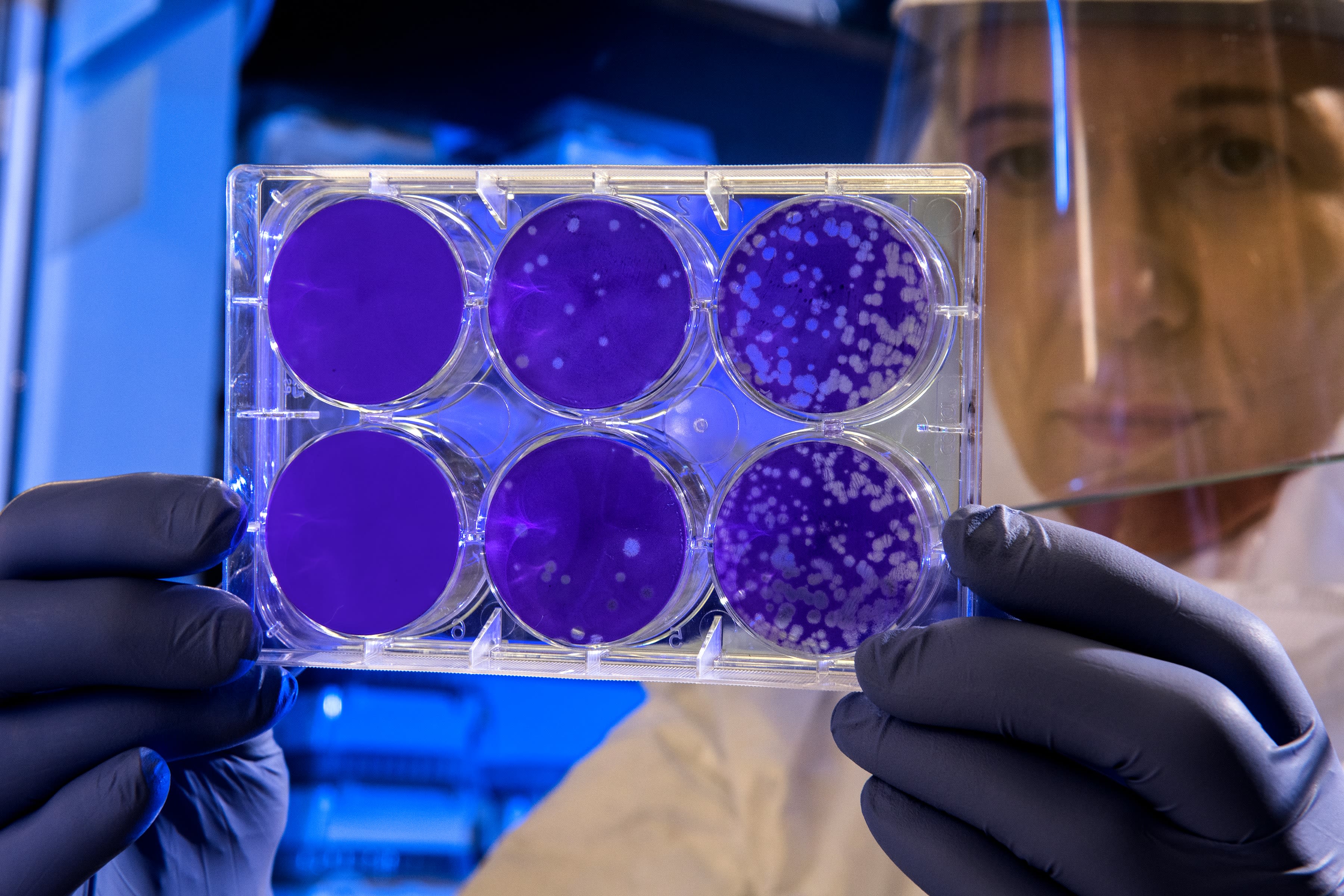 Scientist in lab coat and face shield examining a multi-well plate containing purple-stained samples in a laboratory setting.