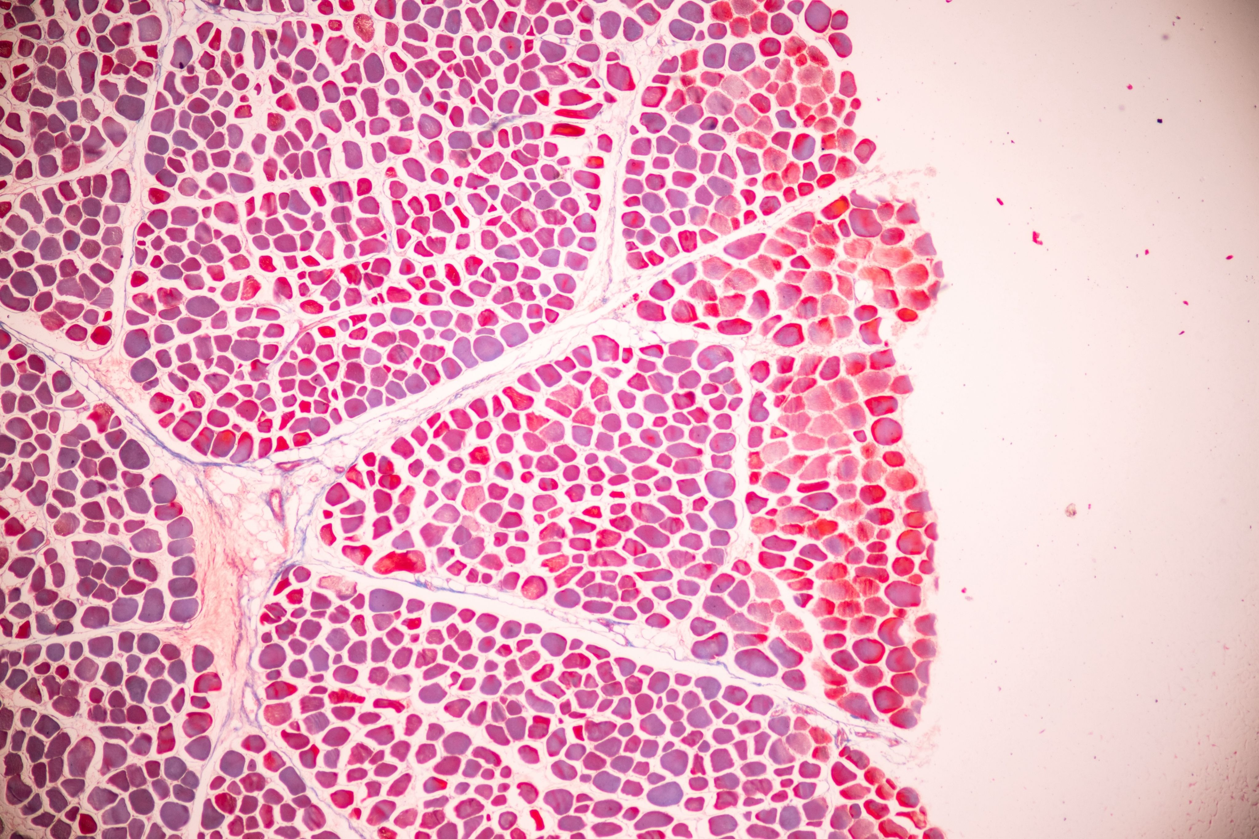 Microscopic view of pink-stained muscle tissue, showing closely packed cells.